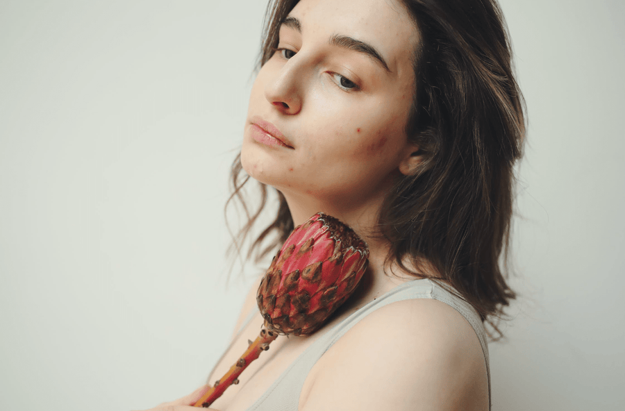 Acné digestive : L'impact de l'alimentation sur notre peau et comment retrouver une peau saine de l'intérieur