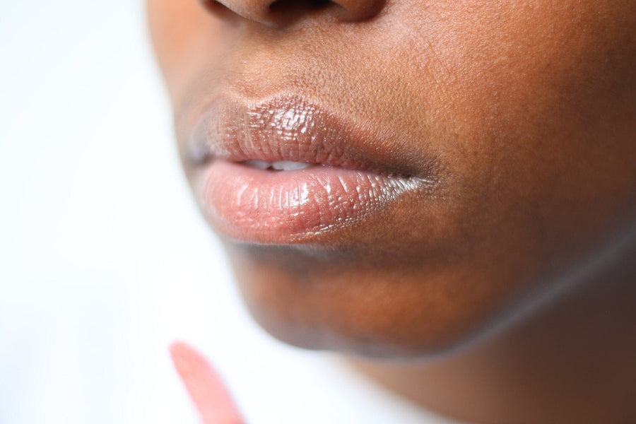 Lèvres gercées : quelles sont les bonnes pratiques à adopter ?