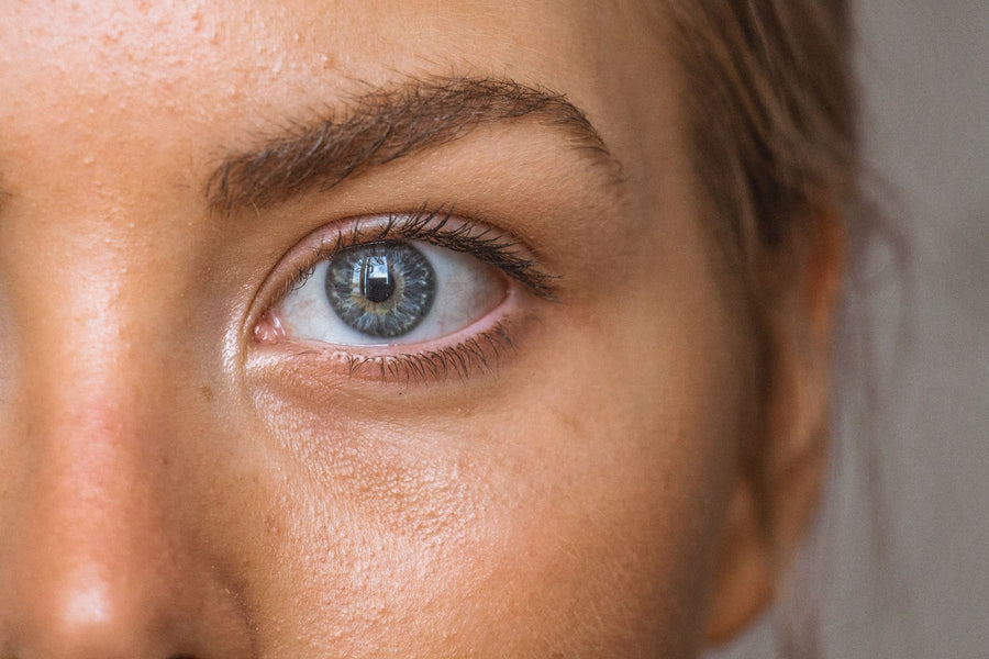 Micro boutons blancs sur la peau : qu'est-ce que c'est et comment